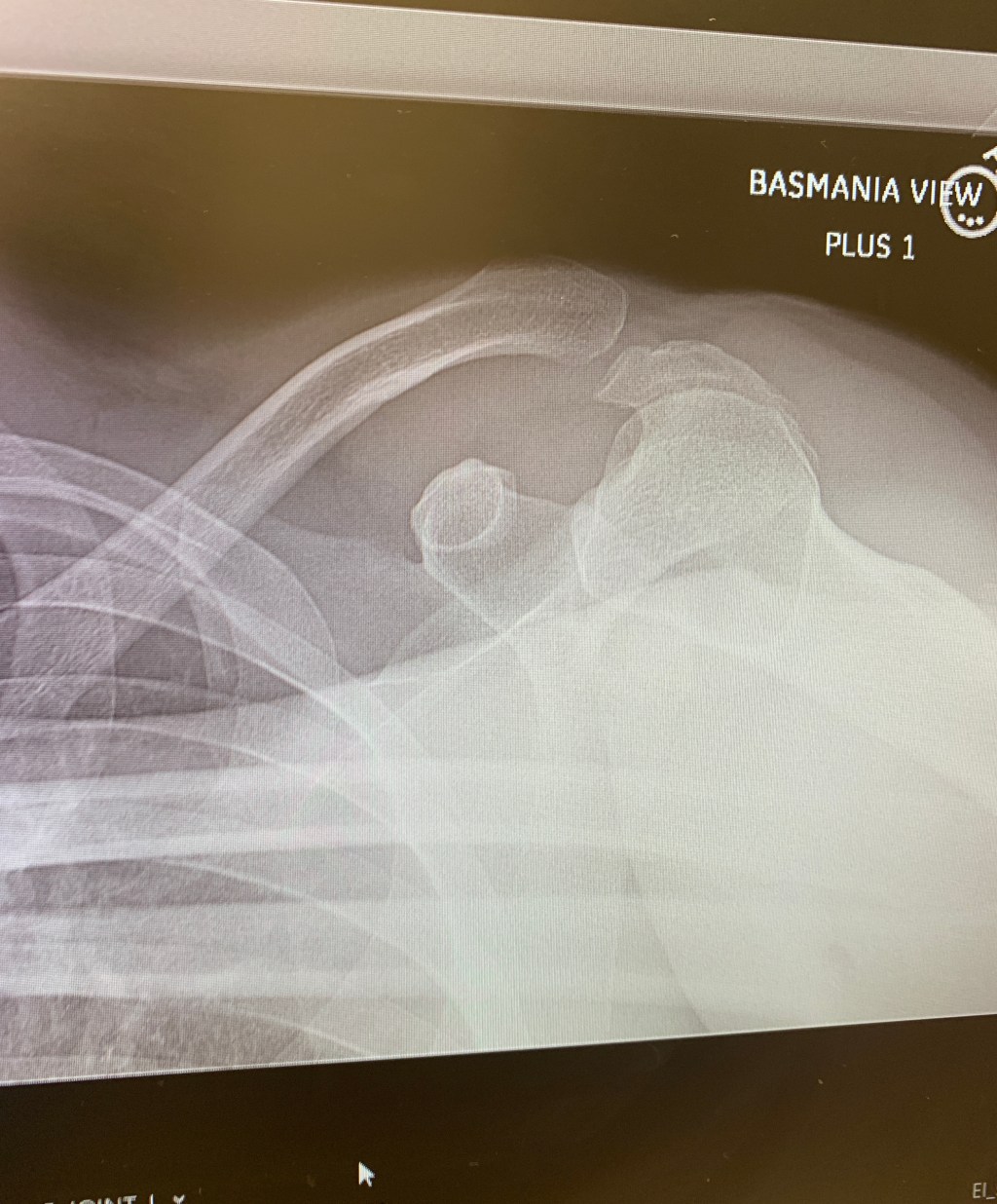 Tuesday’s Headlines: Under the Knife Edition