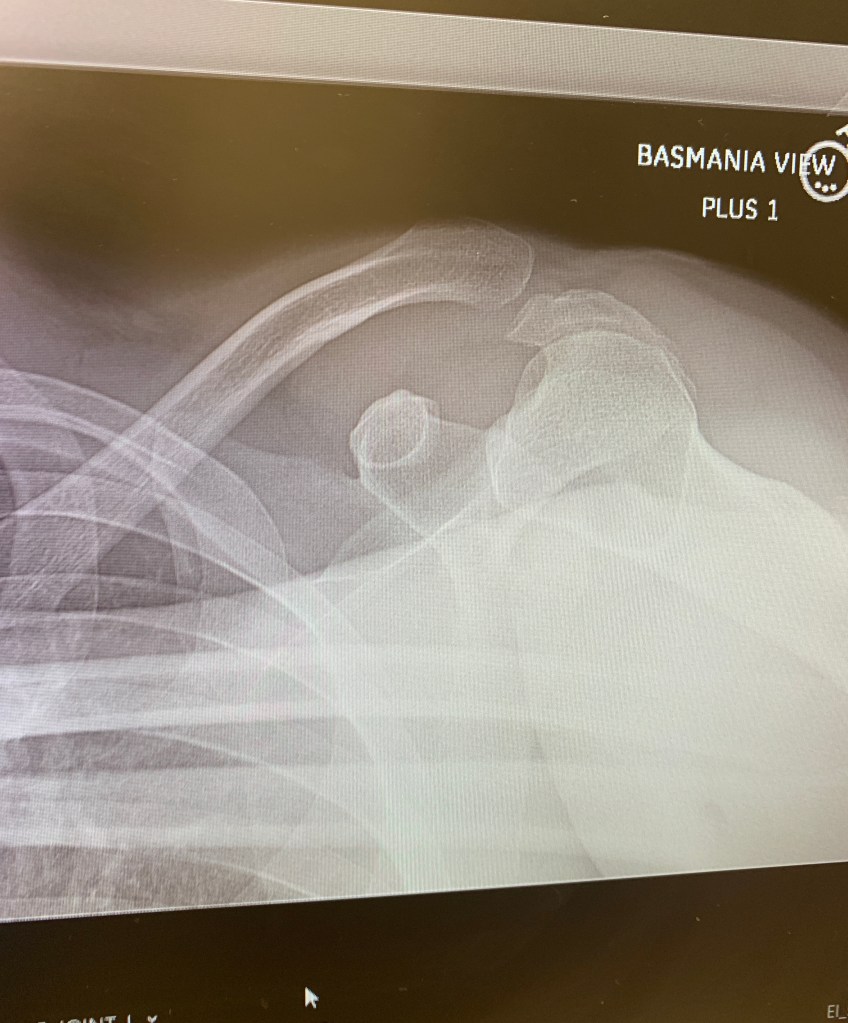 Tuesday’s Headlines: Under the Knife Edition