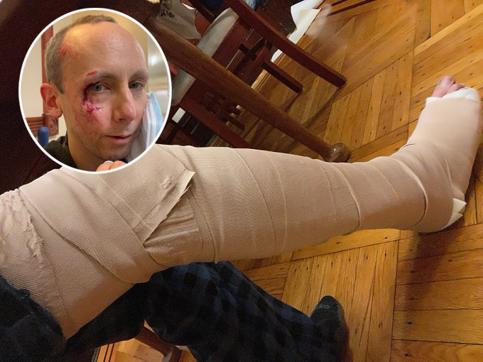 Monday’s Headlines: Don’t Mess With Tony Melone Edition