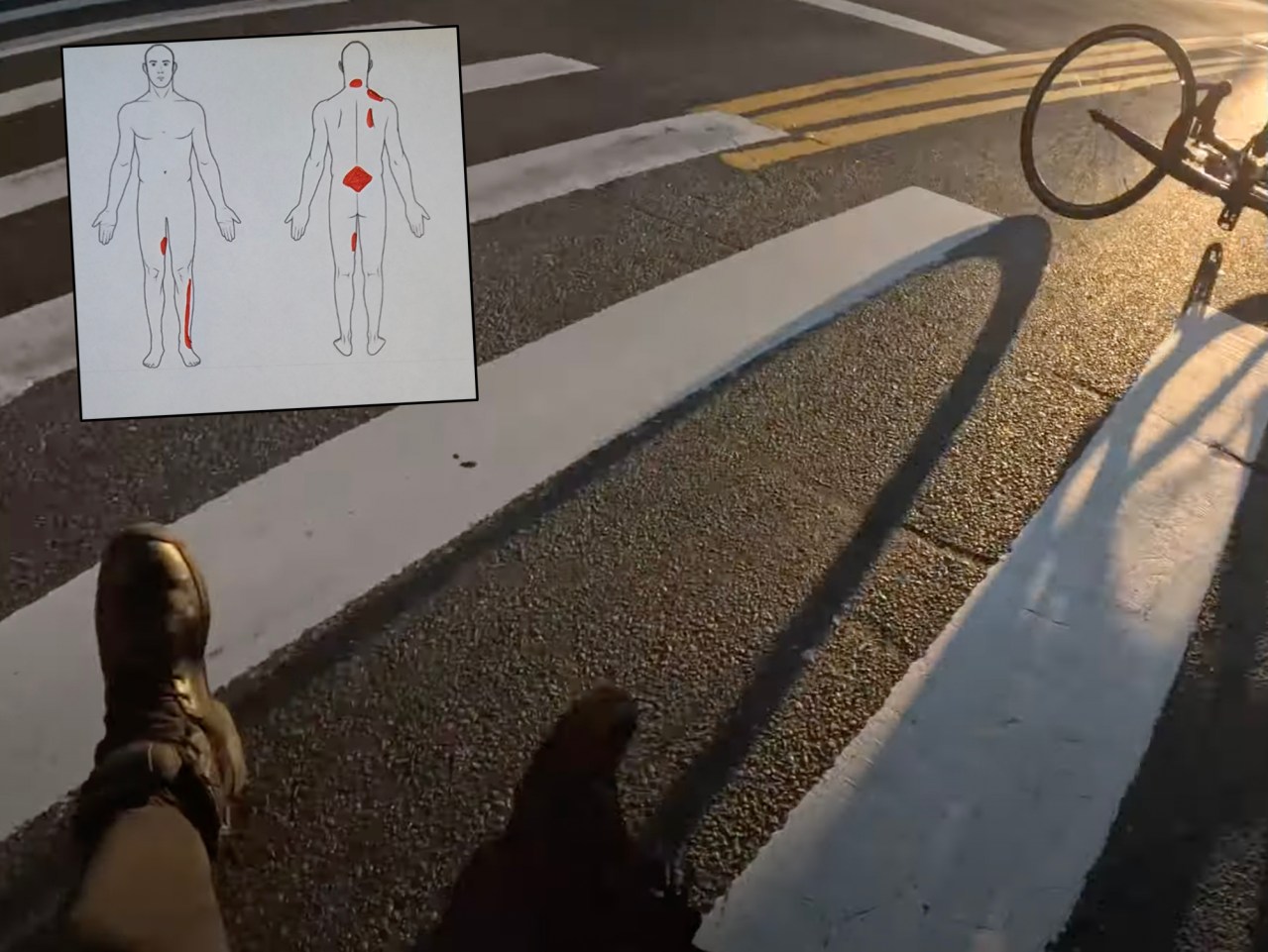 The aftermath of the crash, plus a medical image of ZeroEnigma's injuries.