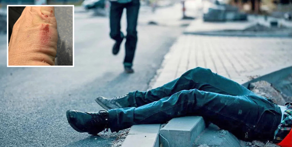 Wednesday’s Headlines: Trip and Fall Edition