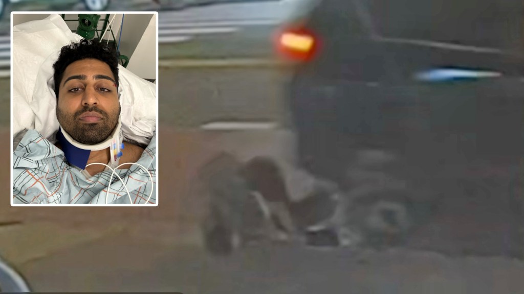 Pedestrian Victimized By A Hit-And-Run Driver Just Wants Cops To Do Their Job